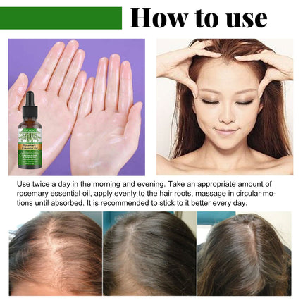 Rosemary Hair Care Essential Oil Anti-loss Hair Growth Hair Care Nourish Scalp Hair Roots