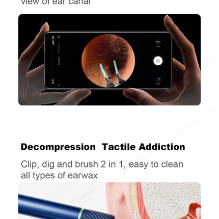 Bebird Note5 Smart Visual Ear Sticks Endoscope Tweezers High Precision Earpick Mini Camera Otoscope Health Care Ear Cleaner